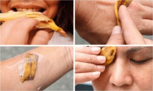 10 beneficios de las cáscaras de plátano para la salud